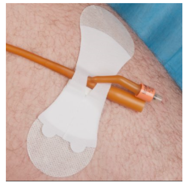 Grip Lok Large non-sterile